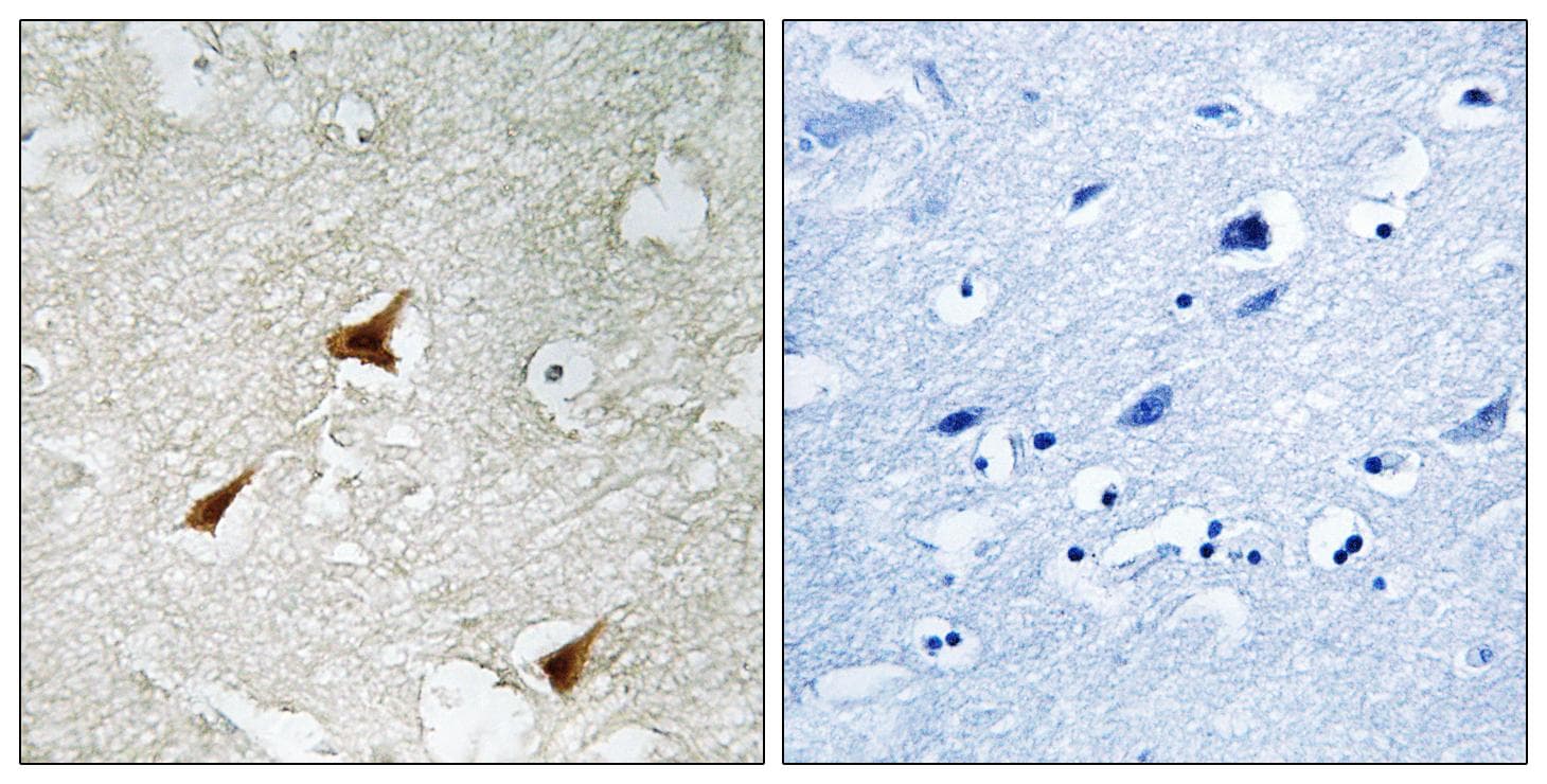 CDKN2D / p19 INK4d Antibody