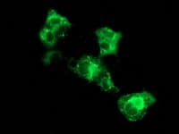 Monoclonal Mouse anti-Human SQSTM1 Antibody (clone OTI5A1, IHC, IF, WB)