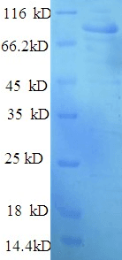 Human HK1 / Hexokinase 1 Protein (Recombinant His)