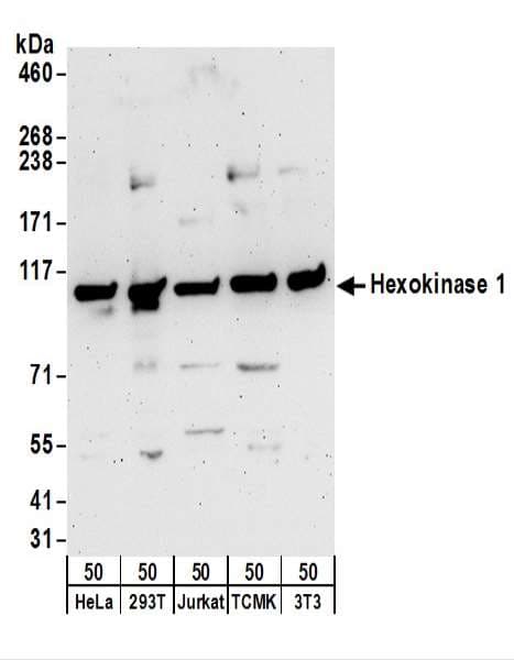 HK1 / Hexokinase 1 Antibody (aa325-375)