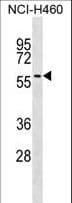 UGT2A3 Antibody (aa324-353)