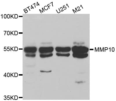 Polyclonal Rabbit anti-Human MMP10 Antibody (IHC, WB)