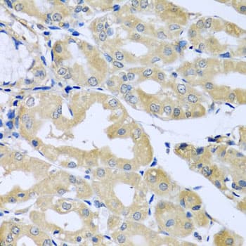Polyclonal Rabbit anti-Human HS1BP3 Antibody (IHC, WB)