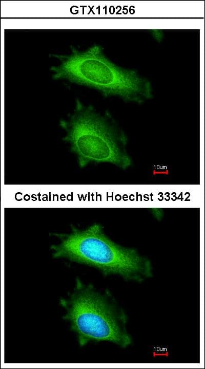 MX1 / MX Antibody (aa194-475)