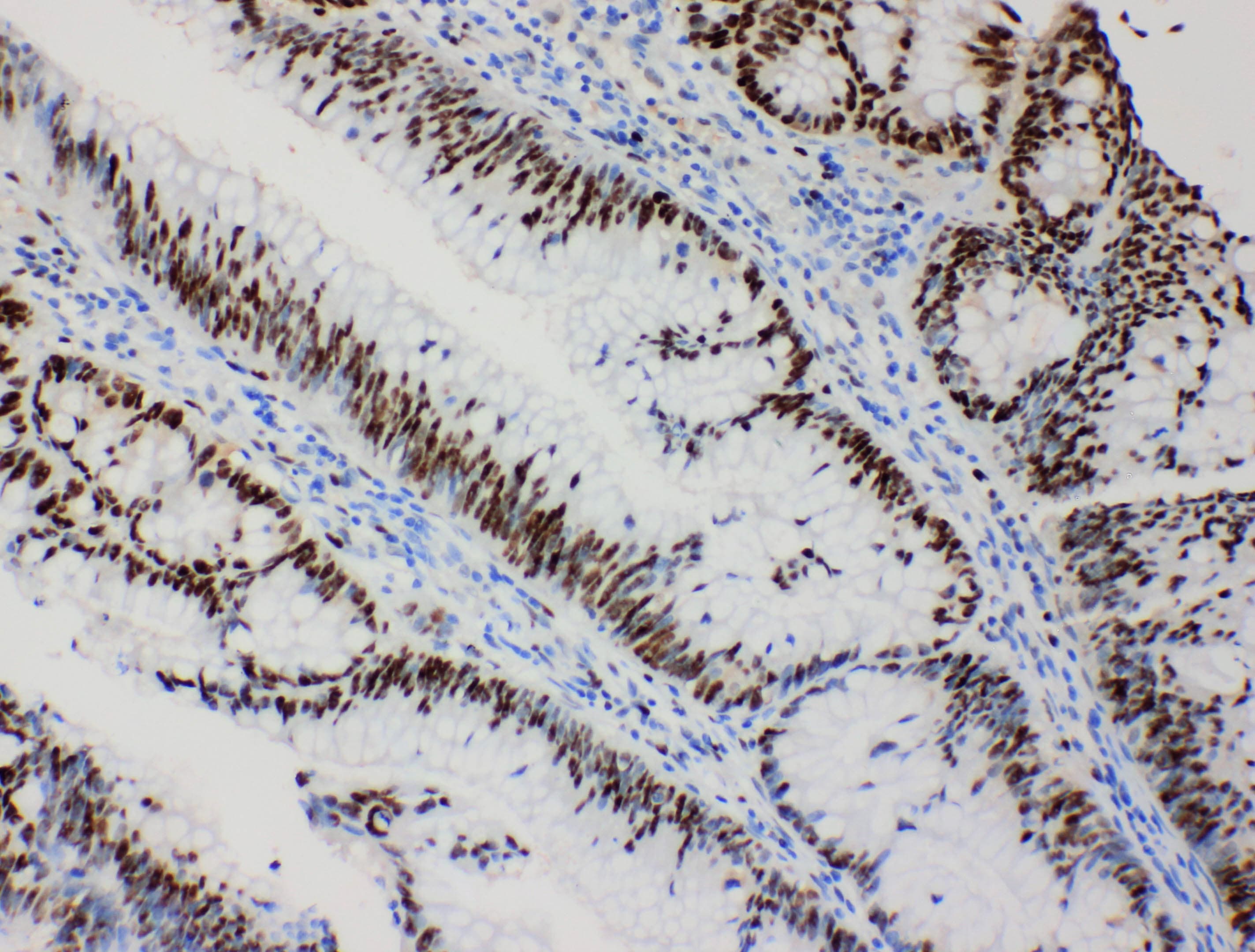 Polyclonal Rabbit anti-Human MCM2 Antibody (aa889-904, IHC, WB)