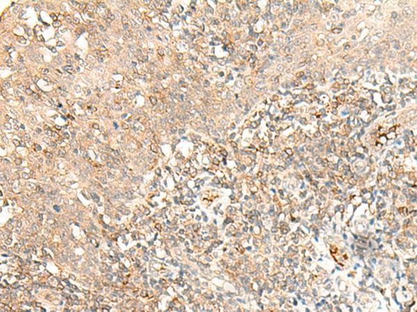 MOBKL2B / MOB3B Antibody