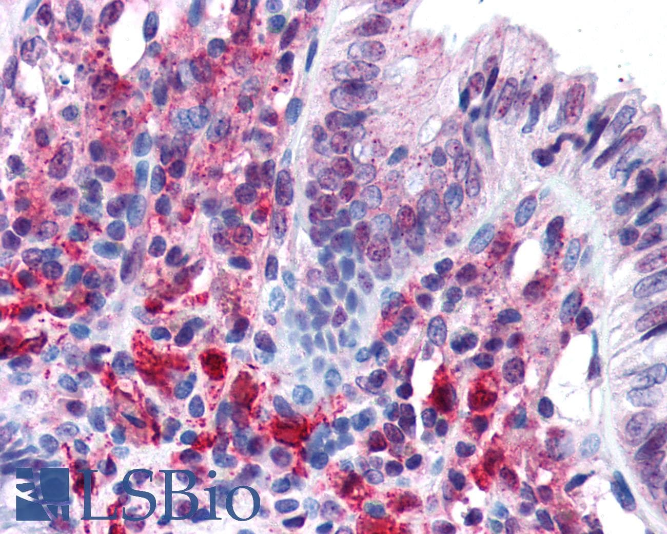 PathPlus™ GLUP / PACRG Antibody