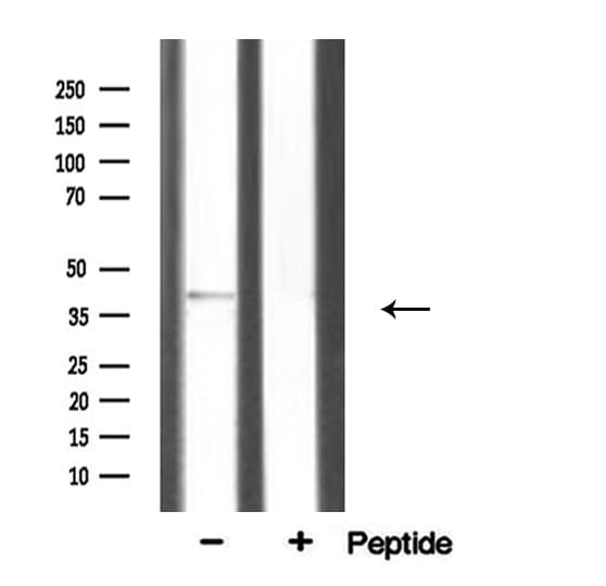 Polyclonal Rabbit anti-Human SGCA / DAG2 Antibody (IF, WB)
