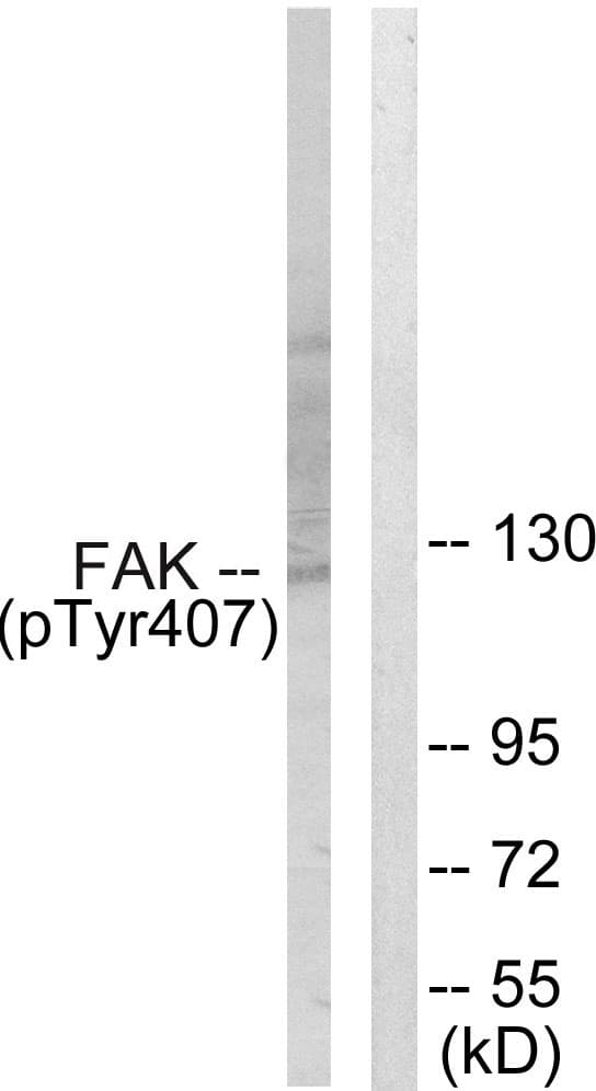 FAK / Focal Adhesion Kinase Antibody (phospho-Tyr407)