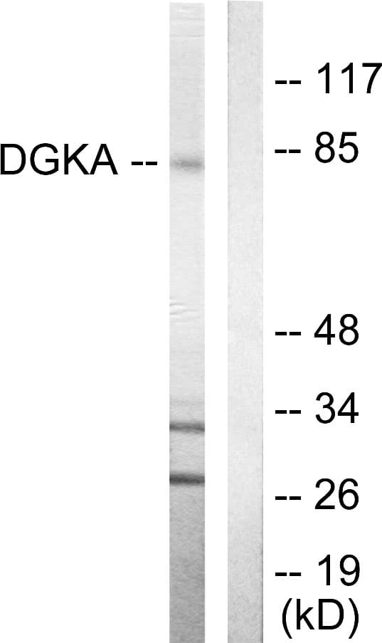 DGKA Antibody (aa304-353)