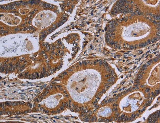 Polyclonal Rabbit anti-Human GJB4 / CX30.3 / Connexin 30.3 Antibody (IHC, WB)