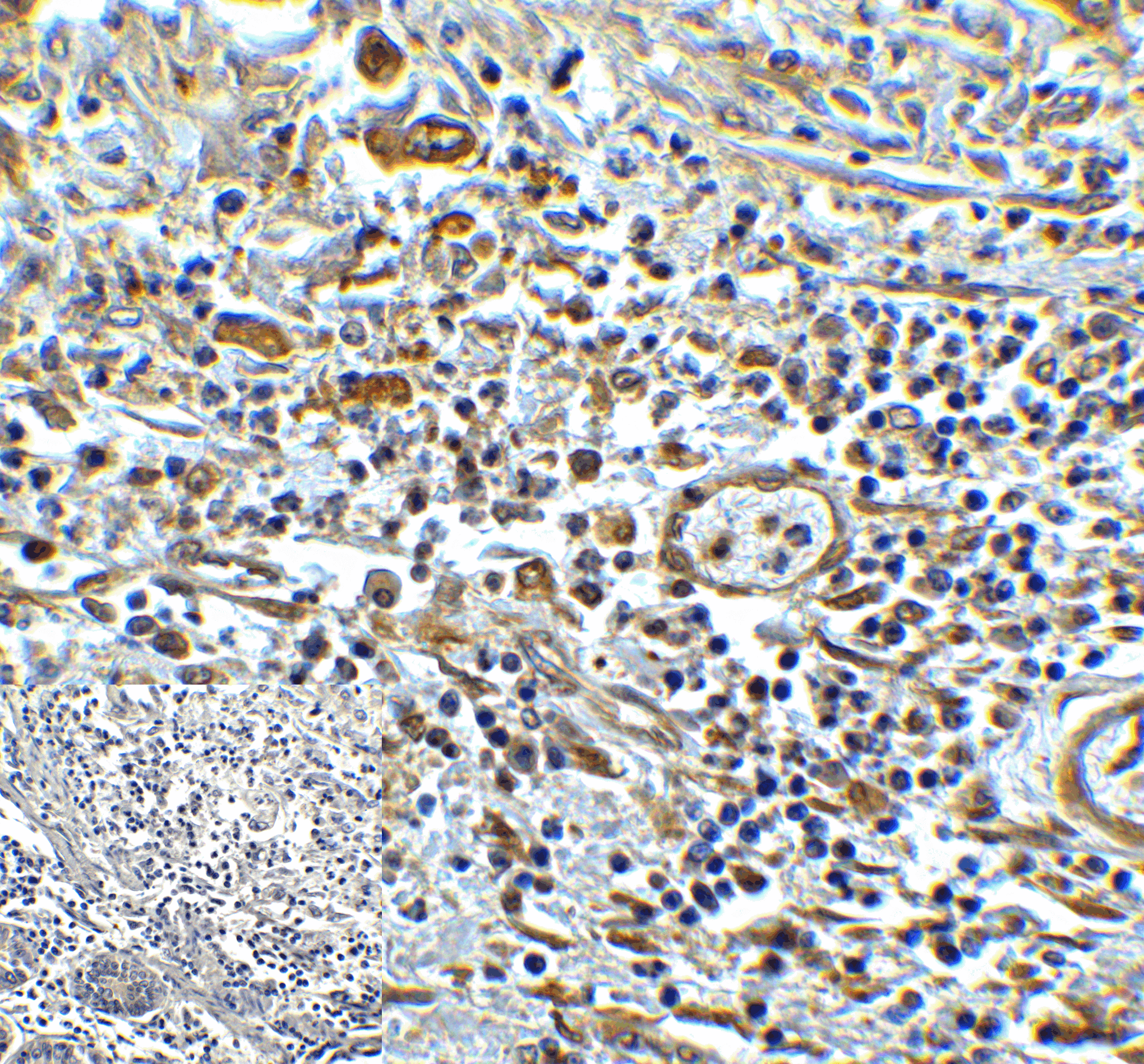IHC-plus™ TMIGD2 Antibody (clone 8A1)