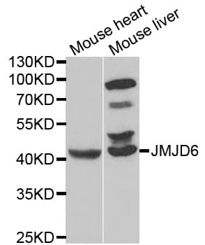 Polyclonal Rabbit anti-Human JMJD6 / PSR Antibody (IHC, IF, WB)