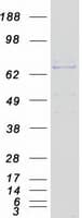 Human EHHADH / Enoyl-Coa Hydratase Protein (Recombinant Myc-DDK (Flag))