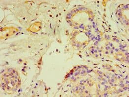 GTF2H2C Antibody (aa1-260)
