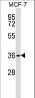 MAP2K3 / MEK3 / MKK3 Antibody (aa132-160)