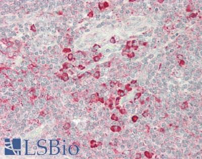 IHC-plus™ Polyclonal Rabbit anti-Human FBLN5 / Fibulin 5 Antibody (IHC, WB)