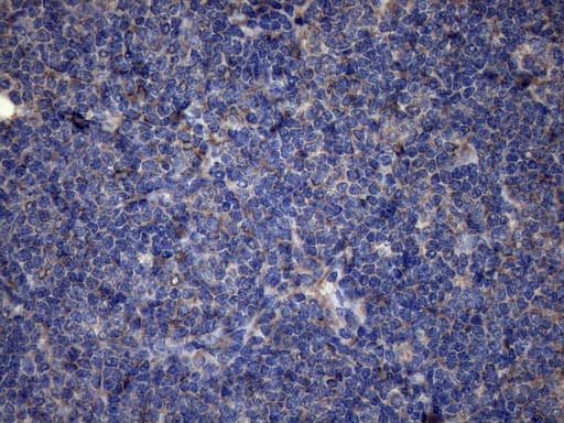 DJ858B16.2 / PISD Antibody (aa80-340, clone OTI6C3)