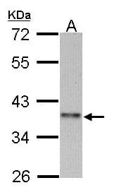 Polyclonal Rabbit anti-Human CCNI2 Antibody (aa170-369, WB)