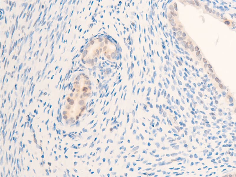 ERBB2 / HER2 Antibody (phospho-Tyr877)