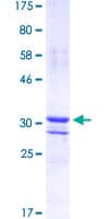Human SP7 / Osterix Protein (Recombinant GST, N-terminus)