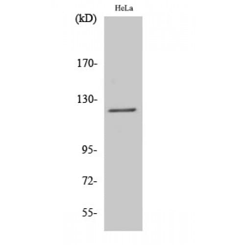 DRPLA / Atrophin-1 Antibody (50-130 aa, N-terminal)
