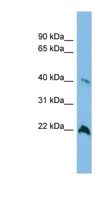 Polyclonal Rabbit anti-Human TGDS Antibody (aa143-192, WB)