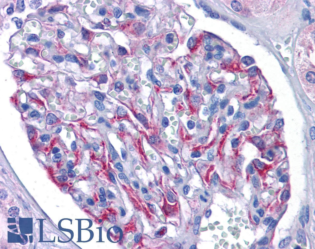 IHC-plus™ Polyclonal Rabbit anti-Human NAA35 Antibody (IHC, WB)
