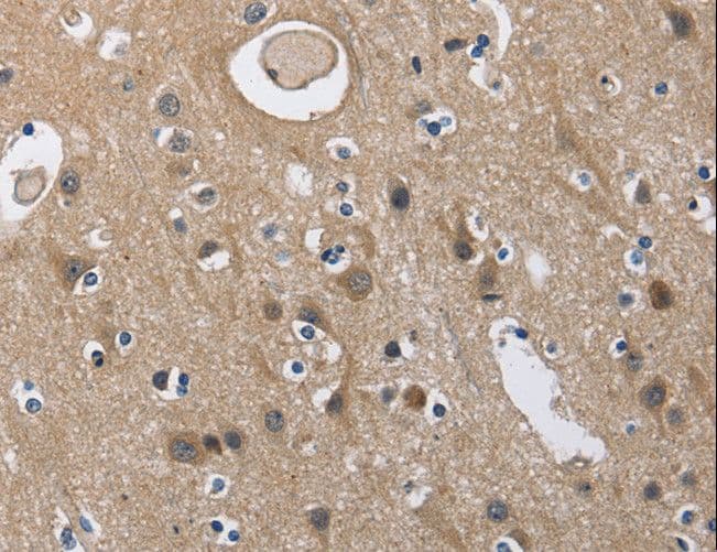 Polyclonal Rabbit anti-Human NK1 / CD160 Antibody (IHC, WB)