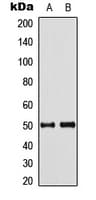 SEPT8 / Septin 8 Antibody (Internal)
