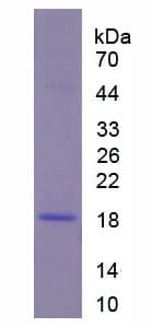Mouse COL8A1 / Collagen VIII Alpha 1 Protein (Recombinant 6His, N-terminus)