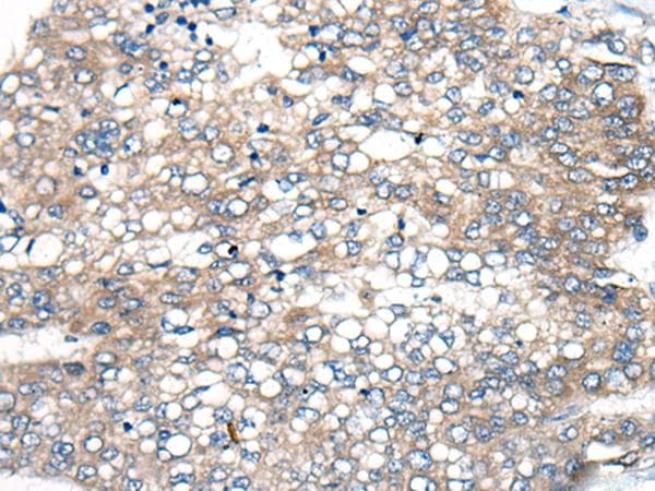 Polyclonal Rabbit anti-Human BBS12 Antibody (IHC)
