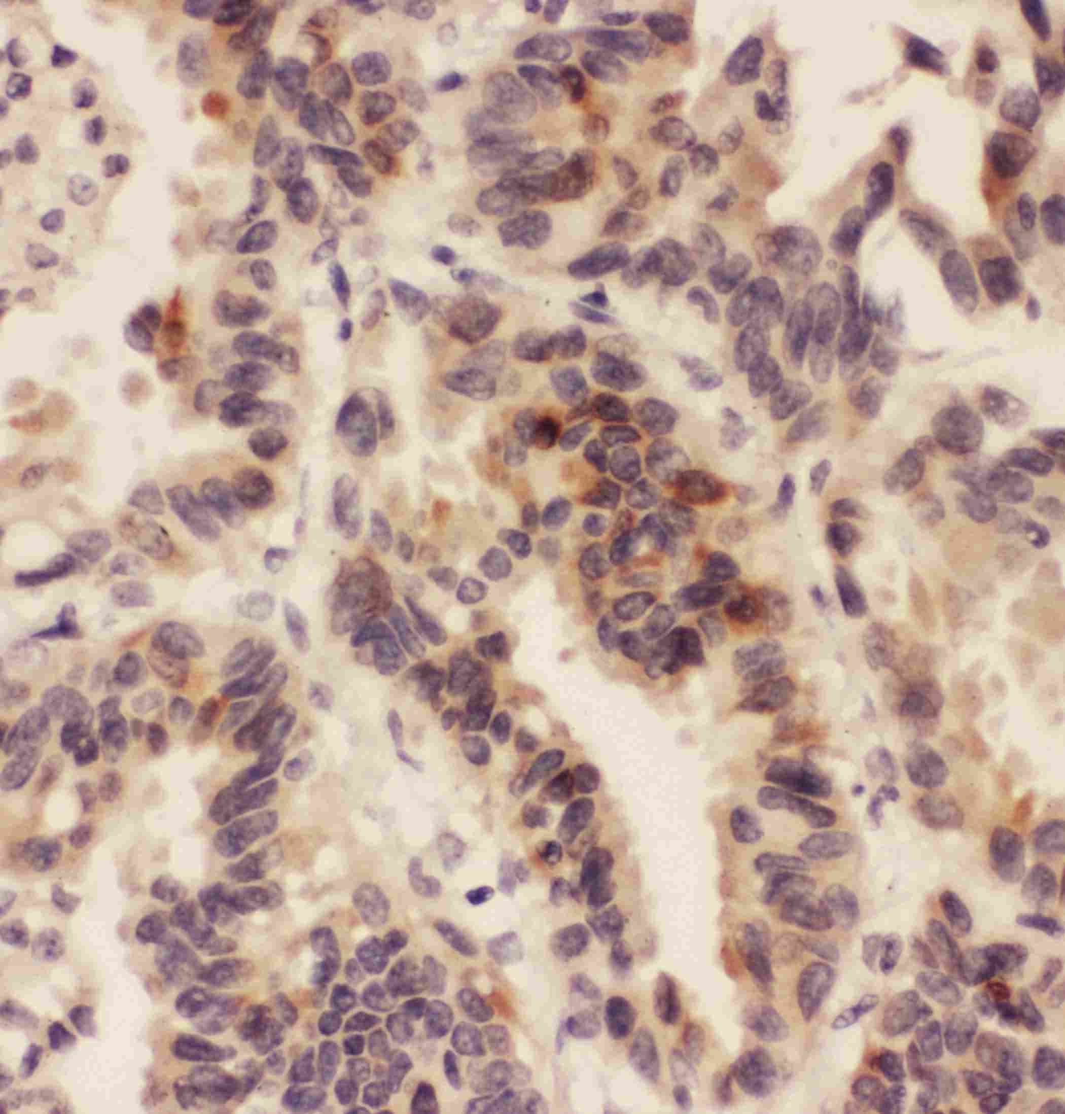 HSD11B1 / HSD11B Antibody (aa16-33)