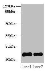 SIRPD Antibody (aa30-197)