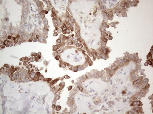 Monoclonal Mouse anti-Human PD-L2 / PDCD1LG2 / CD273 Antibody (clone OTI5A7, IHC)