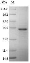Human ALOX5AP / FLAP Protein (Recombinant 6His-SUMO, N-terminus)