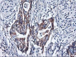 HARS2 Antibody (clone OTI2D6)