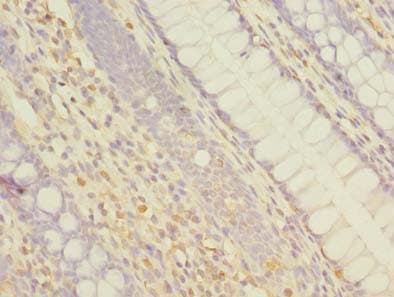 Polyclonal Rabbit anti-Human ABCF3 Antibody (IHC)