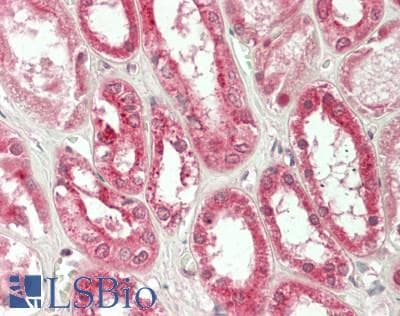 IHC-plus™ MDM4 / MDMX Antibody (clone 4G3)
