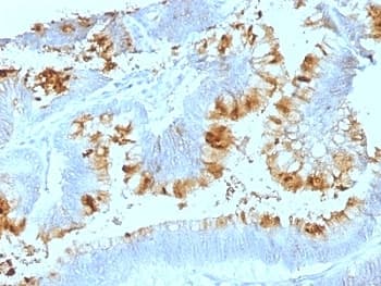 Lewis A Blood Group Antigen Antibody (clone SPM522)