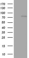 OAS2 Antibody (aa60-335, clone OTI6E6)