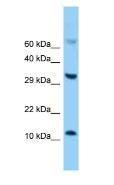 Polyclonal Rabbit anti-Mouse E-FABP / FABP5 Antibody (C-Terminus, WB)