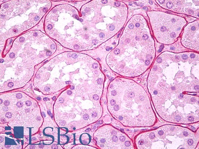 IHC-plus™ Collagen IV Antibody