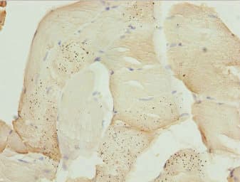 Polyclonal Rabbit anti-Human ZBTB25 Antibody (IHC, WB)