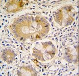 ATG16L1 / ATG16L Antibody (aa454-483)