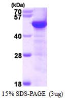Human TUBG1 / Tubulin Gamma 1 Protein (Recombinant His)