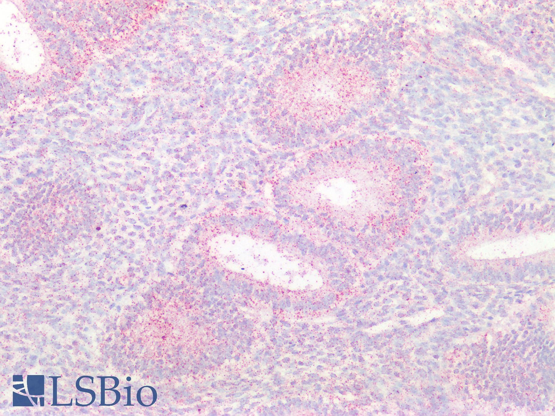 IHC-plus™ Polyclonal Goat anti-Human CTSB / Cathepsin B Antibody (Internal Region, IHC, IF)