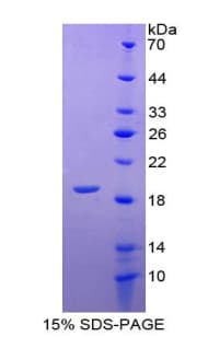 Bovine Leptin Protein (Recombinant His, N-terminus)
