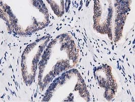 RTFDC1 Antibody (clone OTI1E8)