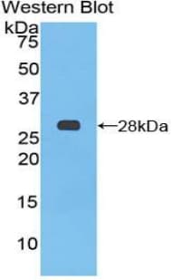 PTCH1 / Patched 1 Antibody (aa213-422)